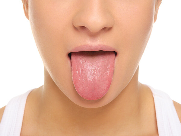 スギ花粉症やダニアレルギーに舌下免疫療法